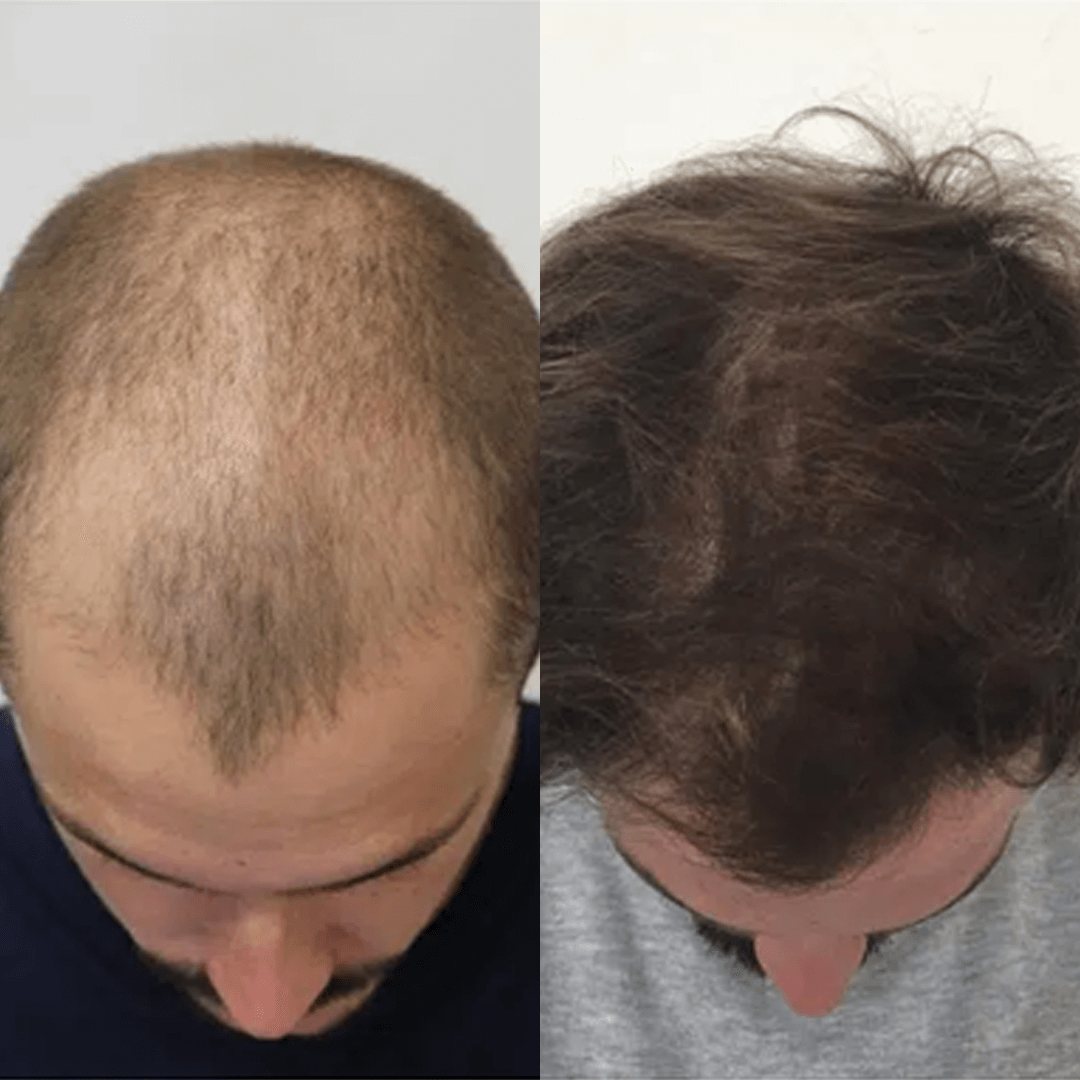 Shampoo Spartan Activador