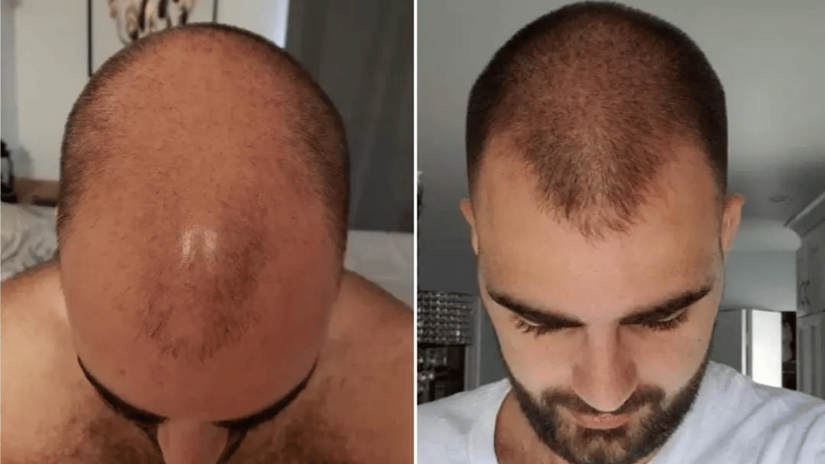 Champú Spartan Activador
