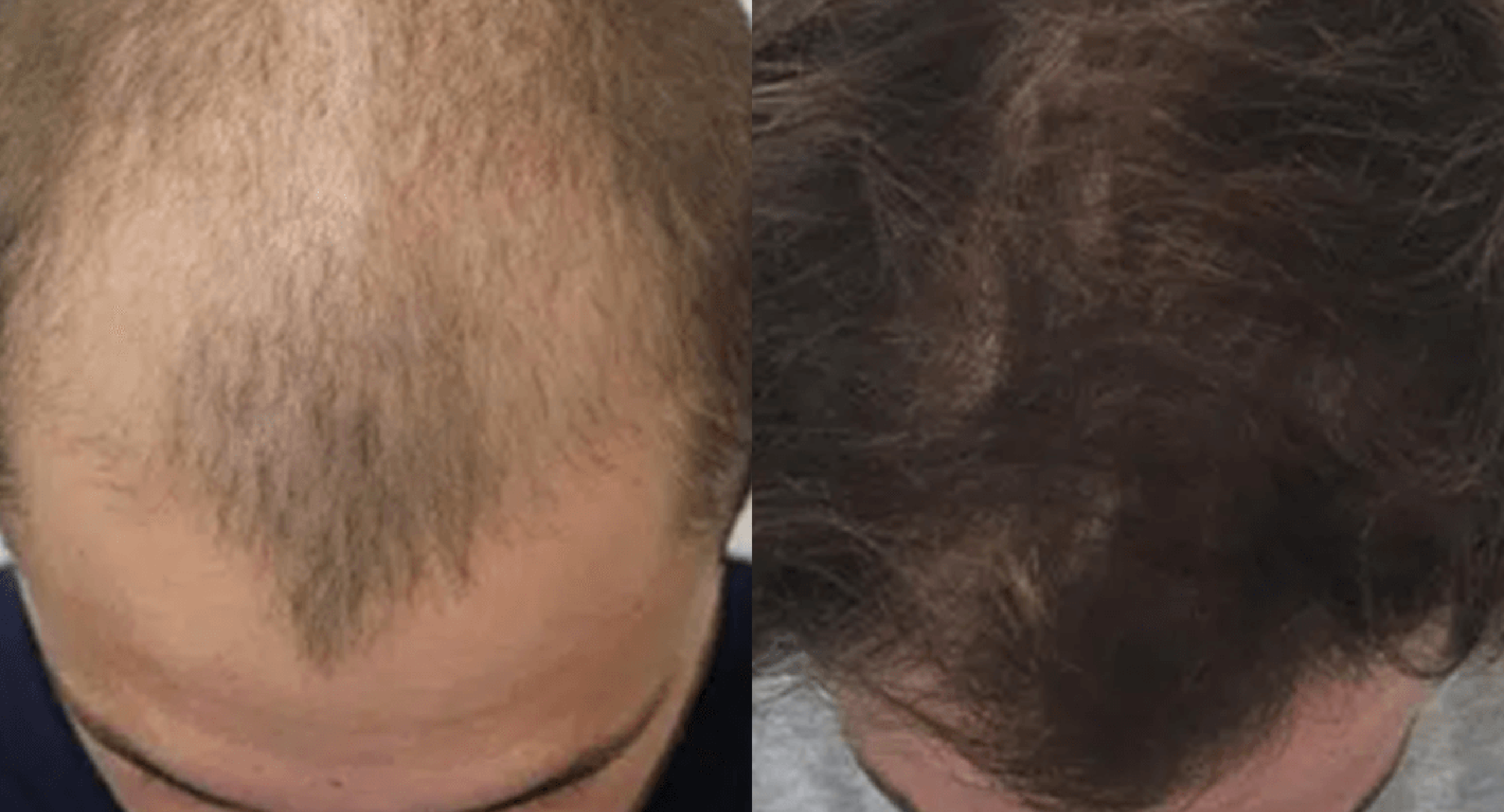 Antes y después - cabello más grueso