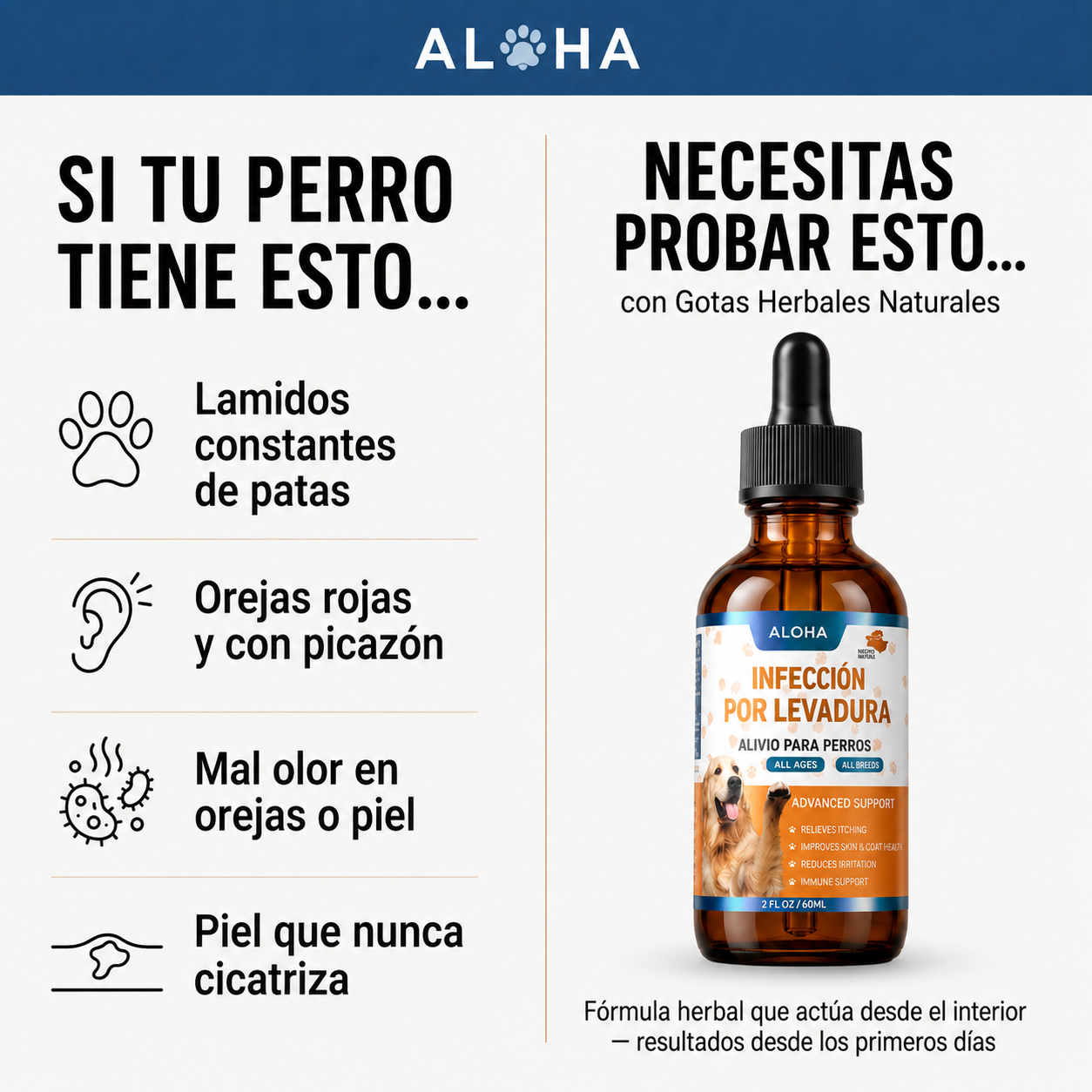 Infección por levadura