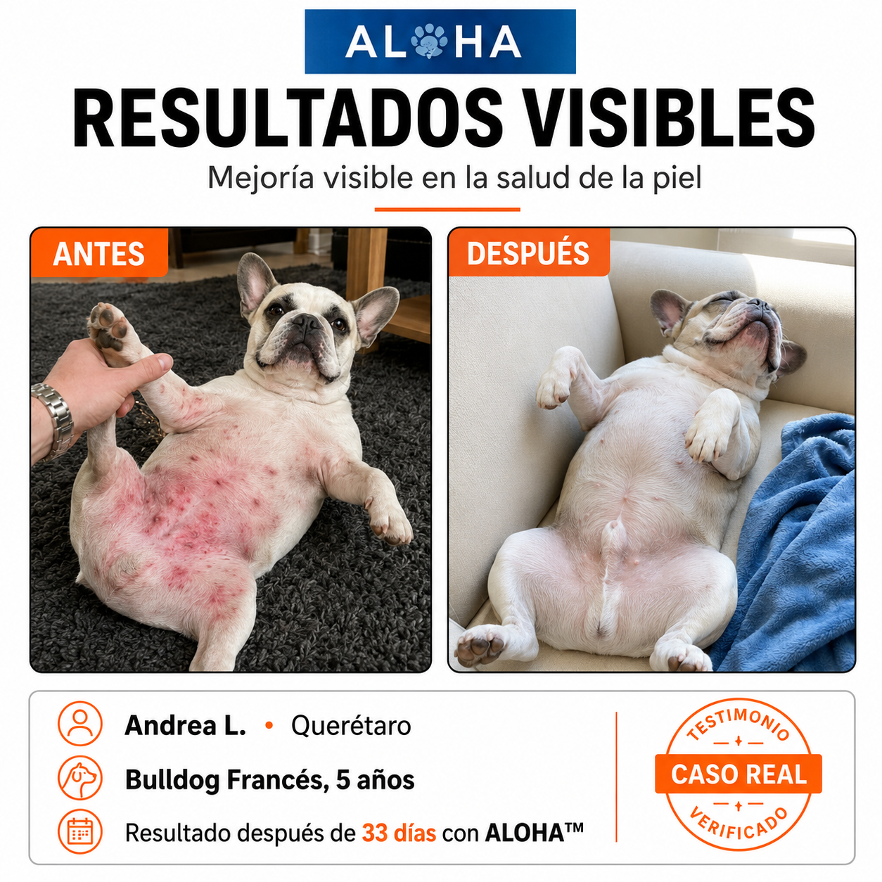 Infección por levadura