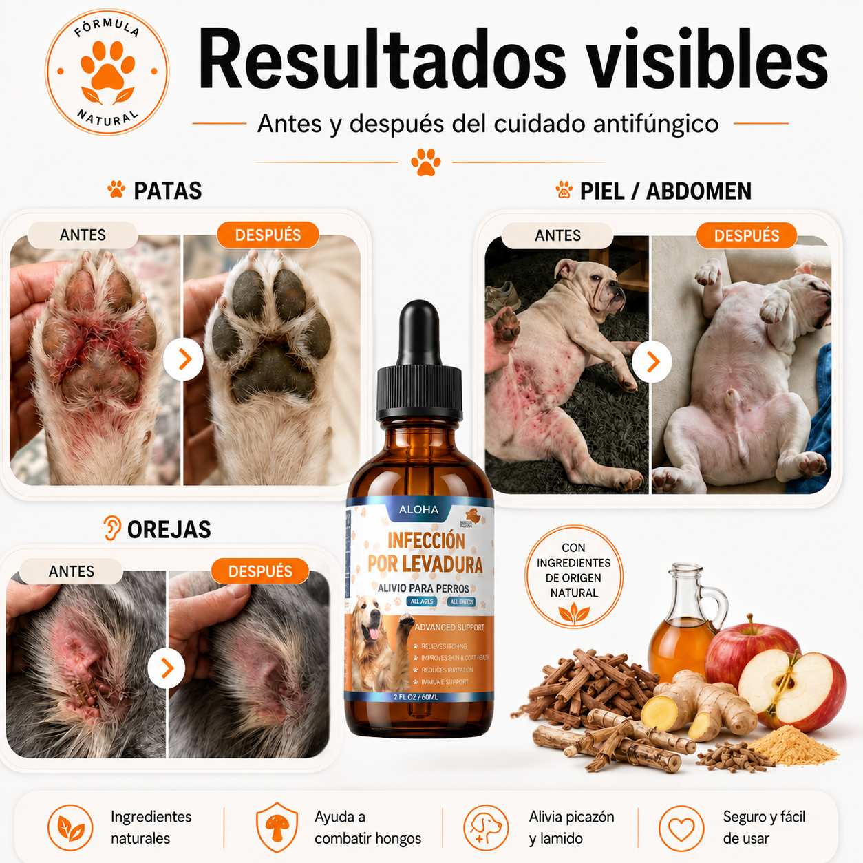 Infección por levadura